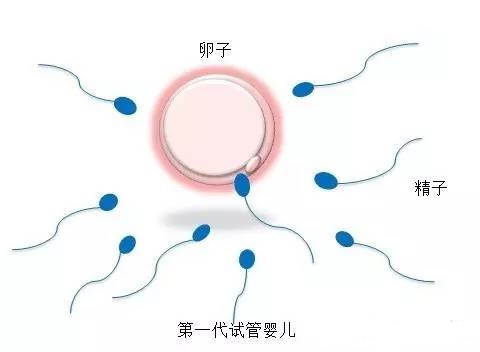 高齡二胎
